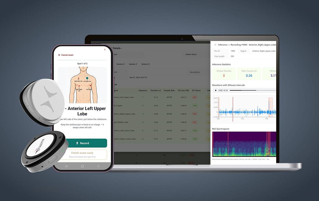 Two Plazma auscultation devices beside a phone guiding the operator through chest recording positions, and a laptop showing the resulting recordings with a wheeze-marked waveform and mel spectrogram.