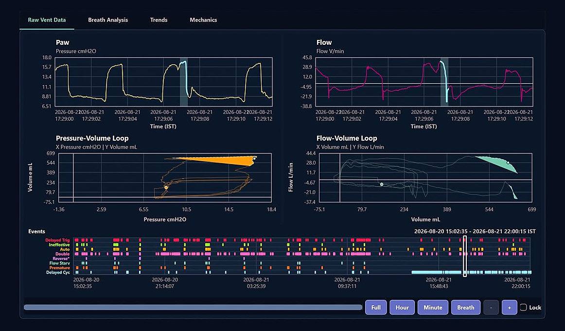 A ventilator analytics dashboard showing pressure and flow waveforms, loop plots, and an asynchrony alert with its cycling detail.